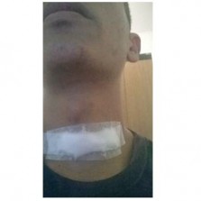 Linha com cerol quase mata motoqueiro em Viçosa.