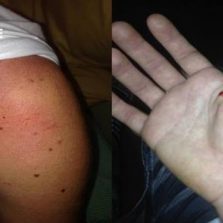 Jovem é agredido no Campus da UFV
