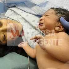 Estudo controverso associa partos por cesariana a autismo