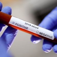 São Paulo vai investir R$ 30 milhões em ações contra o coronavírus