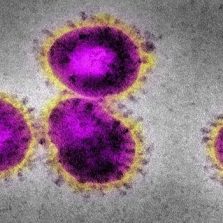 Oque é o coronavírus?