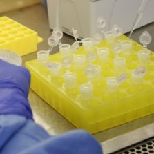 Planos de saúde terão de cobrir exames para novo coronavírus