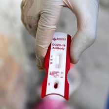 Governo anuncia parceria para produzir vacina contra covid-19
