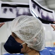 Universidades desenvolvem apoio a diagnóstico de covid-19 com raio-x