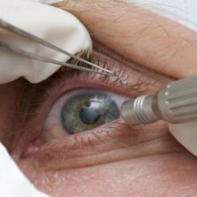 Pandemia faz cair detecção precoce de glaucoma