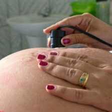 Gestação na adolescência cai 37% em 20 anos, diz estudo