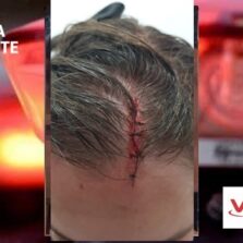 Araponga: Funcionária é agredida por colega de trabalho na Câmara Municipal