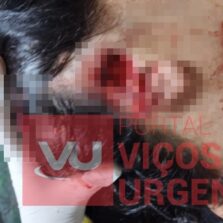 Pitbull foge, ataca e deixa mulher com ferimento grave em Ervália