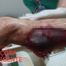 Idoso fica gravemente ferido após ataque de cães de rua em Viçosa