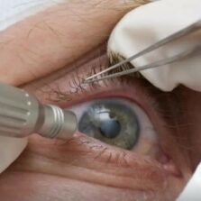 Associações alertam para risco de cegueira e morte por consumo de bebidas adulteradas com metanol